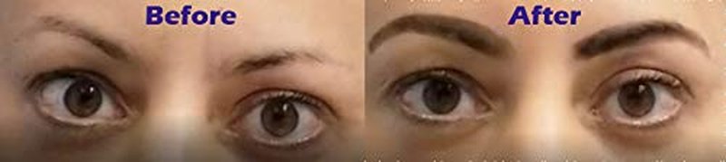 Hair Fiber Concealer - Waterproof Black Hair Loss Solution | Hairline Creator & Eyebrow Enhancer