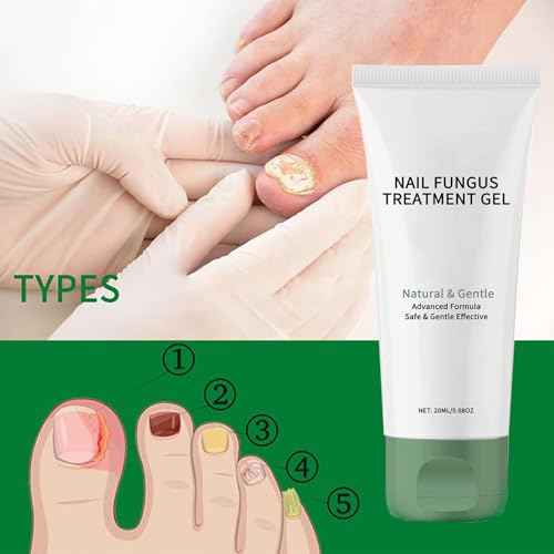 Natural Nail Treatment Gel, Nail Growth Serum for Repair & Strengthener (2)