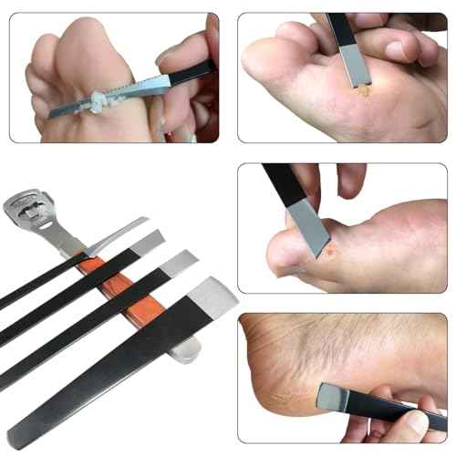 36 Pcs Callus Shaver for Feet Set, Foot Callus Shaver, (1 Stainless Foot File &1 Foot File Heads & 4 Pedicure Knife & 30 Replacement Slices Blades)