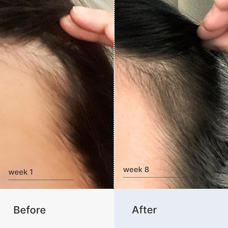 Better Not Younger Hair Thickening Serum for Women Over 40 ? Scalp Care, Hair Density Treatment and Anti-Aging 2fl.oz ? Fortifying Serum with Biotin & Ginger. Promotes Stronger, Thicker-Looking Hair.