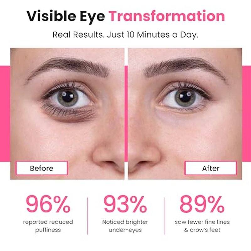 Eye Revitalize ? Red Light Therapy for Dark Circles & Eye Bags