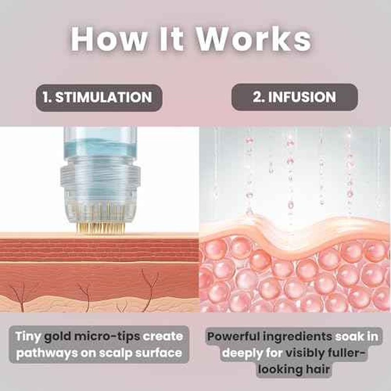 Glov Beauty Micro Infusion Hair Renewal Kit ? 0.25mm Gold Derma Stamp with Hyaluronic Acid, Peptide & Botanical Serum Ampoules | Hydrating Scalp Treatment for Fuller, Thicker-Looking, Healthier Hair