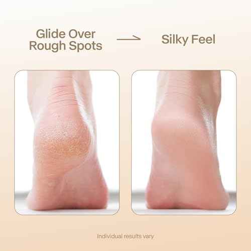 NOVAL Callus Remover Gel 250ml and Gold Handle Nano Glass Foot File Set£¬Dead Skin Remover for Feet, Exfoliating Gel for Cracked Heels and Smooth Pedicure Care