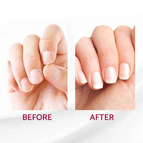 IBD Reconstrux Nail Repair Treatment ? Nail Strengthener for Weak & Damaged Nails, Nail Growth Treatment for Peeling & Brittle Nails ? 0.125 fl oz, 2 Pack