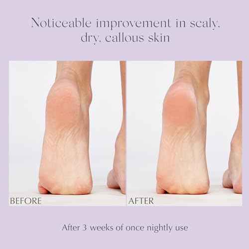 EXUVIANCE Exfoliating & Conditioning Foot Balm, 1.7 oz