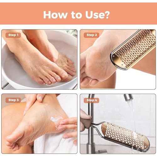 Foot File Foot Scrubber Pedicure - Callus Remover for Feet Easkep Professional Grater Rasp Foot Scraper Corns Callous Removers Cracked Dead Skin Remover for Dry and Wet Feet (Golden)