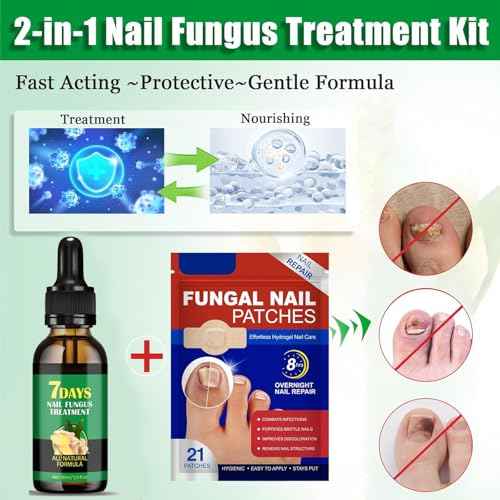 Fungal Nail Patches & Ginger 7 Days Nail Treatment ? Daily Nail Support for Stronger, Clearer Looking Nails ? Easy-to-Use Hydrogel Patches + Natural Formula, 21 Patches & 30ml