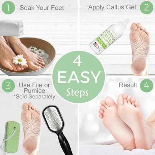 Dr. Entre's Callus Remover Gel: 8oz Extra Strength with Precision Applicator, Callus Remover for Feet, Foot Callus Remover, Foot Care, Pedicure Tools Supplies, Dead Skin Remover