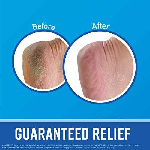 O'Keeffe's Working Hands Hand Cream (3.4 oz Jar) and Healthy Feet Foot Cream (3.2 oz Jar) - Repairing Skincare for Extremely Dry, Cracked Hands and Feet, Travel Size
