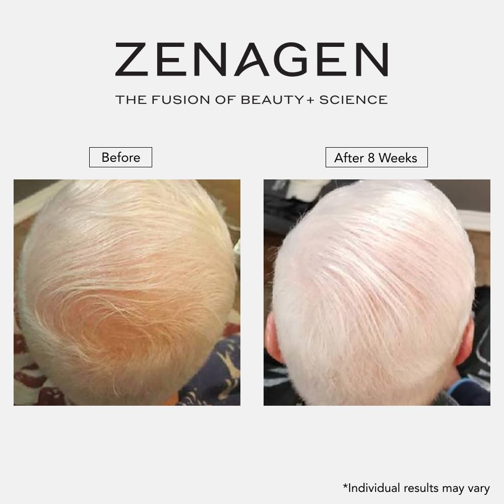 ZENAGEN Revolve Men's Thickening Shampoo | Supports Appearance of Fuller, Healthier-Looking Hair, Developed for Fine & Visibly Thinning Hair, Plant-Based, 5-Minute Treatment, 75 mL / 2.5 oz