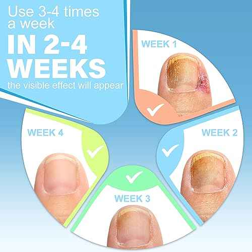 Ingrown Toenail Treatment w/Ingrown Toenail Drops Reliever & Softener,Double Sided Pedicure Nail Lifter Tool for Easy Trimming Care Thick Nail & Ingrown Toe Nail,Toenail Cleaner Kit for Men Women