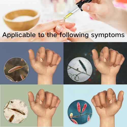 3PCS Ginger Nail Treatment, Nail Treatment, Ginger Cuticle Care Oil for Nails, Multi-Purpose Nail Oil