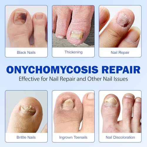 Fungal Nail Patches 21 PCS -Toenail Treatment Extra Strength - Nail Repair for Restores Damaged Nails and Appearance of Discolored