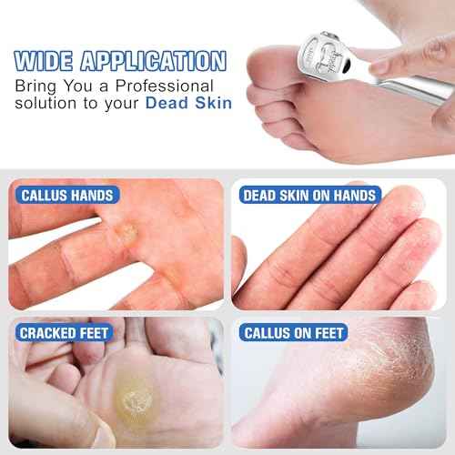 MIUKAA Callus Shaver Kit with 10 Blades, Callus Remover for Feet & Hands, Professional Dead Skin and Corn Removal Tool, Heel Scraper for Cracked Heels - Pedicure Tools for Smooth Feet