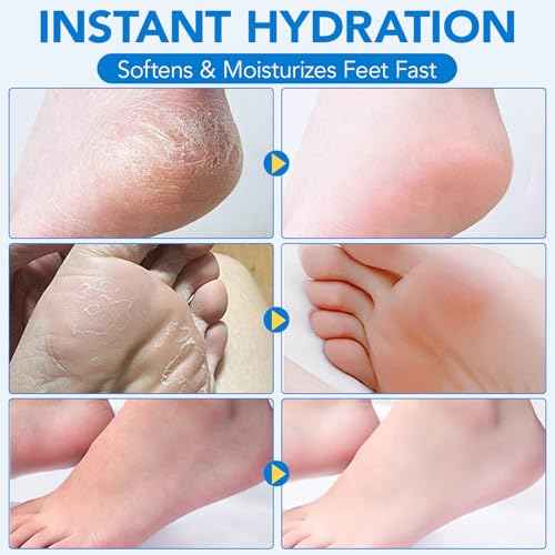 Urea Cream 60% plus Salicylic Acid 2% Urea Foot Care Stick, Foot Cream for Foot Callus Remover, Feet Moisturizer Stick for Dry Cracked Heels, Hands, Knees, Hydrating Heel Balm, Easy To Use