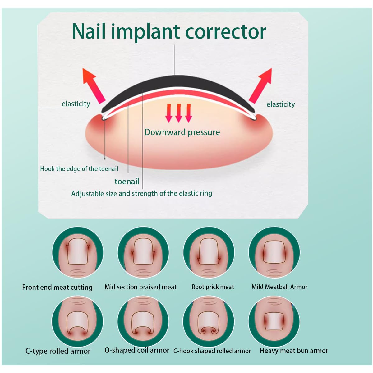 JIUDOUCUOIngrown Toenail correction Kit, Professional Nail Care Tools with Correction Clips and Adhesive Pads,Four correction clips can correct two toenails simultaneously