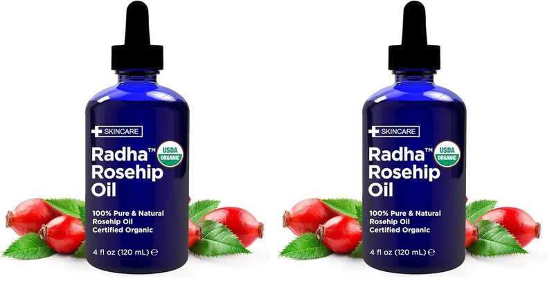 Organic Rosehip Seed Oil - 100% Pure Cold Pressed Carrier Oil for Face, Hair, Skin & Nails | 4 oz (Pack of 2)