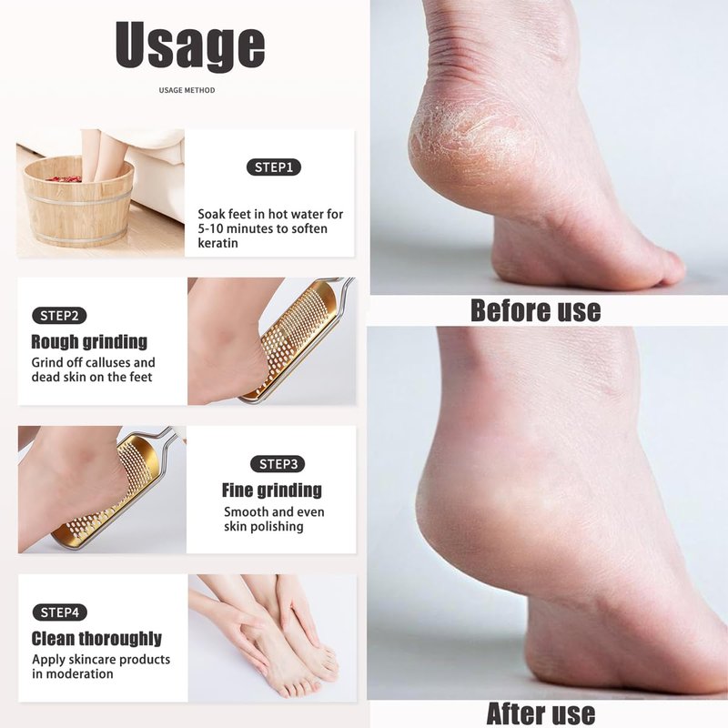 White Foot File Callus Remover, Foot File for Feet – Professional Pedicure Tool for Dead Skin Removal & Cracked Heels – Ultimate Stainless Steel Foot Scrubber for Soft, Healthy Feet