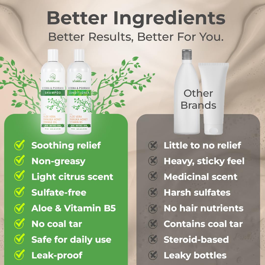 Wild Naturals Eczema and Psoriasis Treatment - Anti-Dandruff Deep Conditioner for Damaged, Dry Hair and Seborrheic Dermatitis Scalp