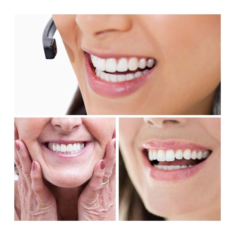2 Pairs, Temporarily Restore Confident Smiling, Adjustable for Men and Women, Top and Bottom (1)