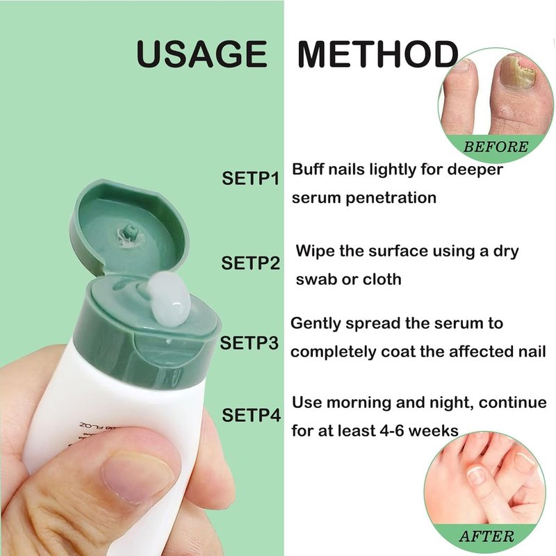 Natural Nail Care Gel, Nutraboost Strengthening Cuticle Serum for Damaged & Brittle Nails, 20ml (1 pcs) (2pcs)