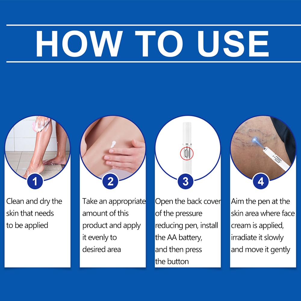 etitek 2 Pack Varicose Veins Treatment for Legs,Varicose Veins Blue Light Therapy Set Fast Soothe Blood Circulation Natural Formula Smooth Skin