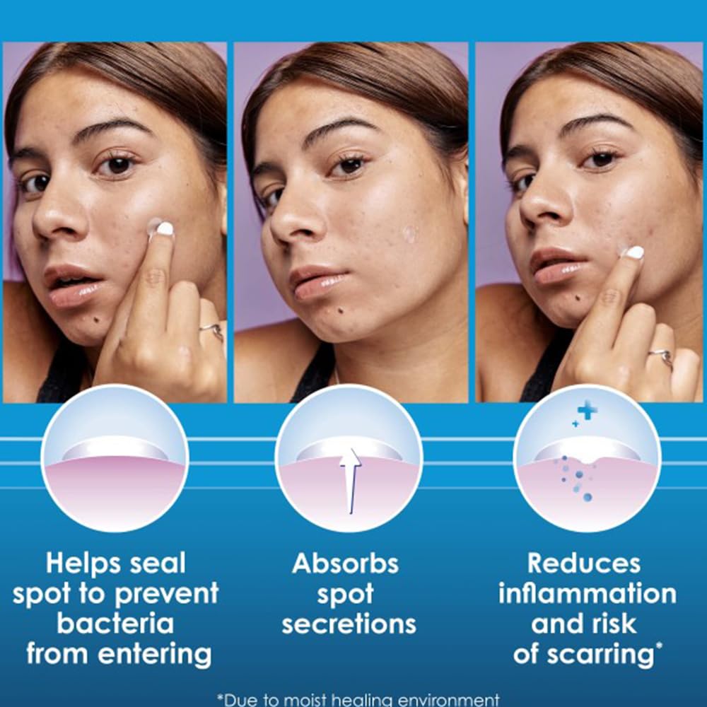 Clearasil Stubborn Acne Control 5in1 Pimple Patch, 18 Count (Pack of 3)
