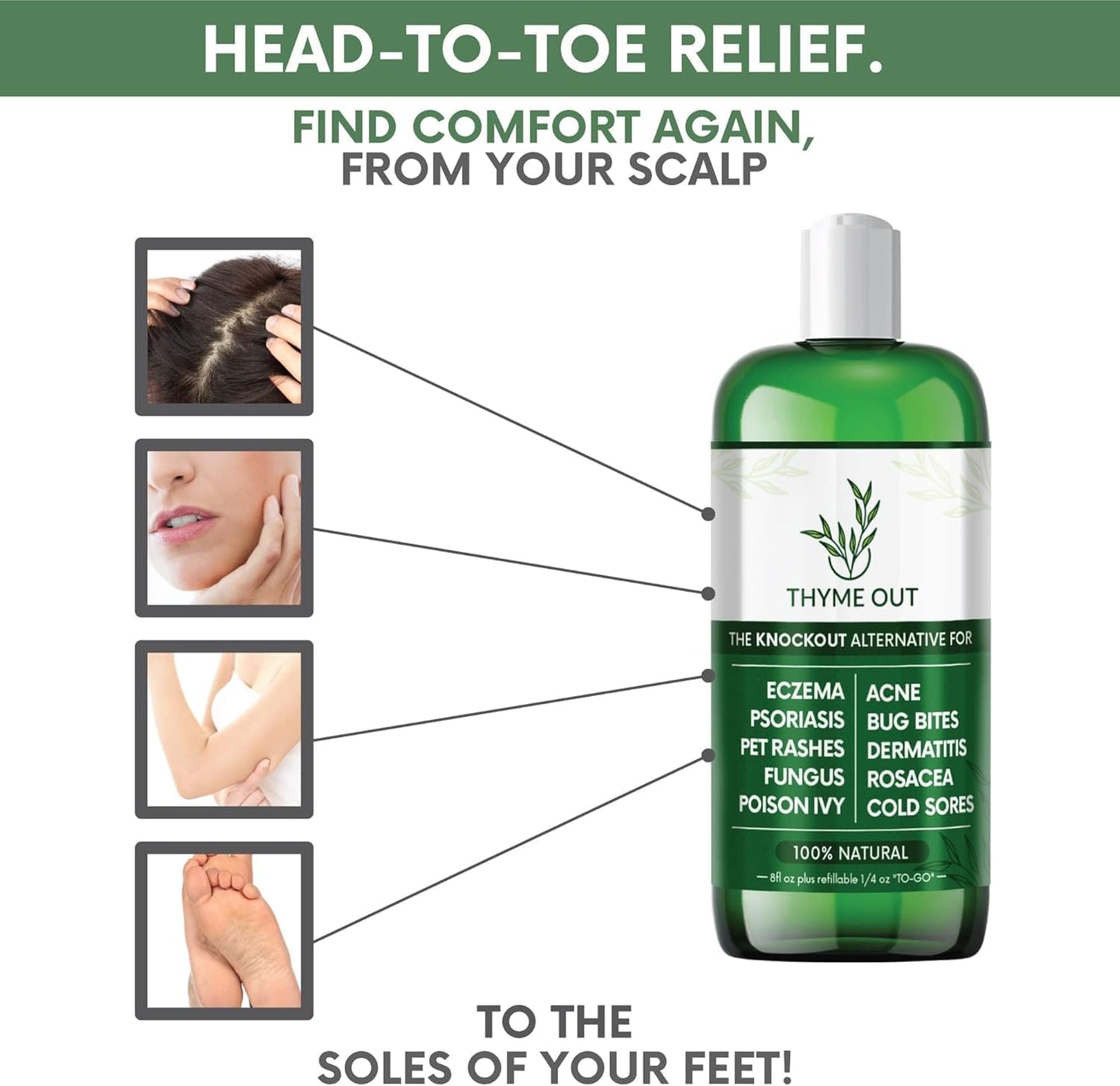 Thyme Out Plus Natural Skin Relief Spray for Eczema, Acne, Bug Bites & Irritated Skin – Safe for Babies, Kids & Pets – Gentle Non-Toxic Face & Body Mist with Organic Thyme + Oat Support