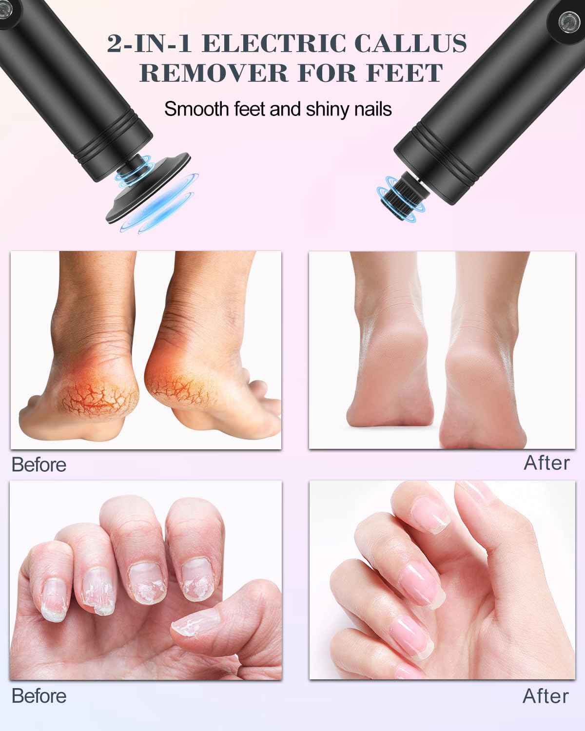 Electric Callus Remover & Foot Sander - 2-in-1, 2000mAh, 9 Speed, LED Display, Replaceable Discs - Rose