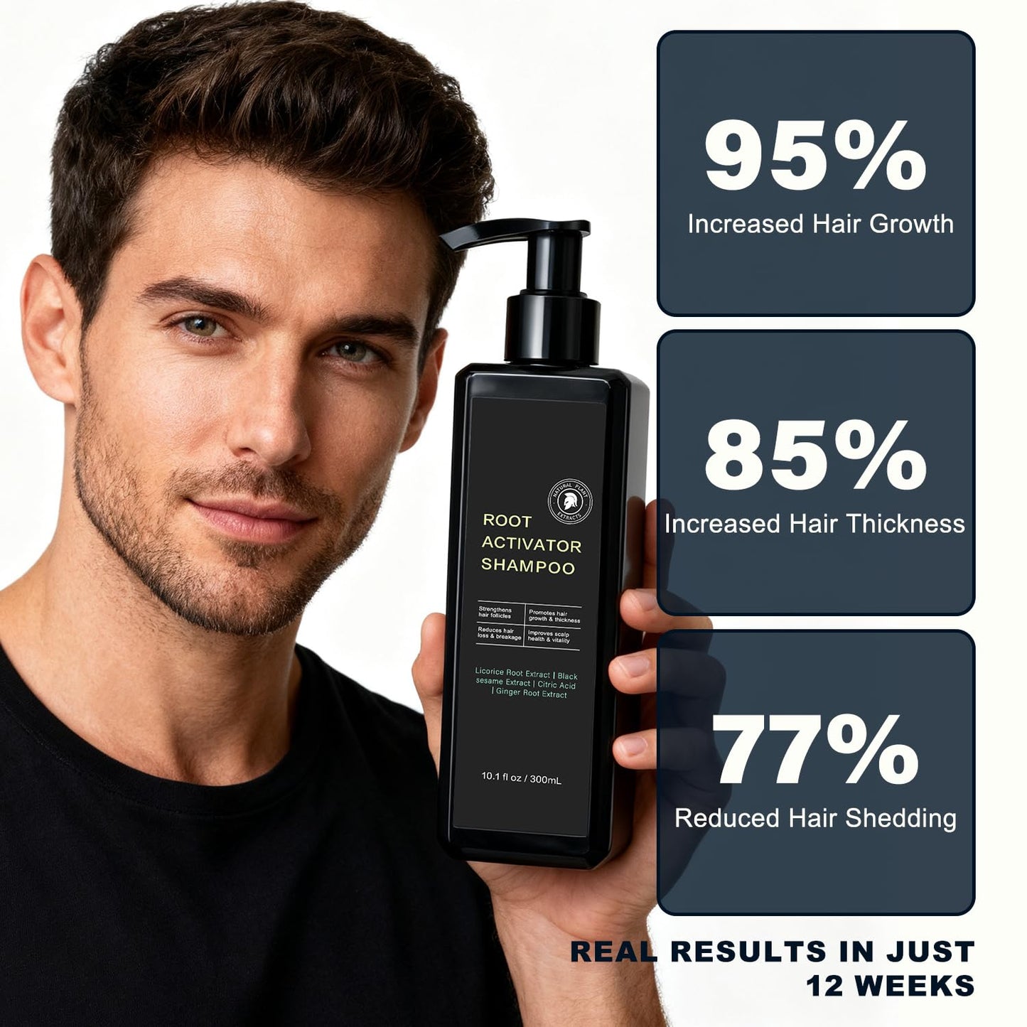 Root Activator Shampoo For Men - Hair Growth Shampoo for Hair Loss and Thinning Hair - 300 mL/10.1 fl oz