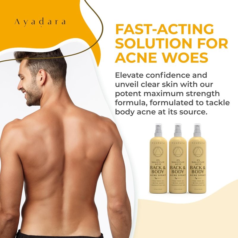 Acne Body Spray - 2% Salicylic Acid Treatment for Back & Body Acne | 3-Pack for Teens & Adults