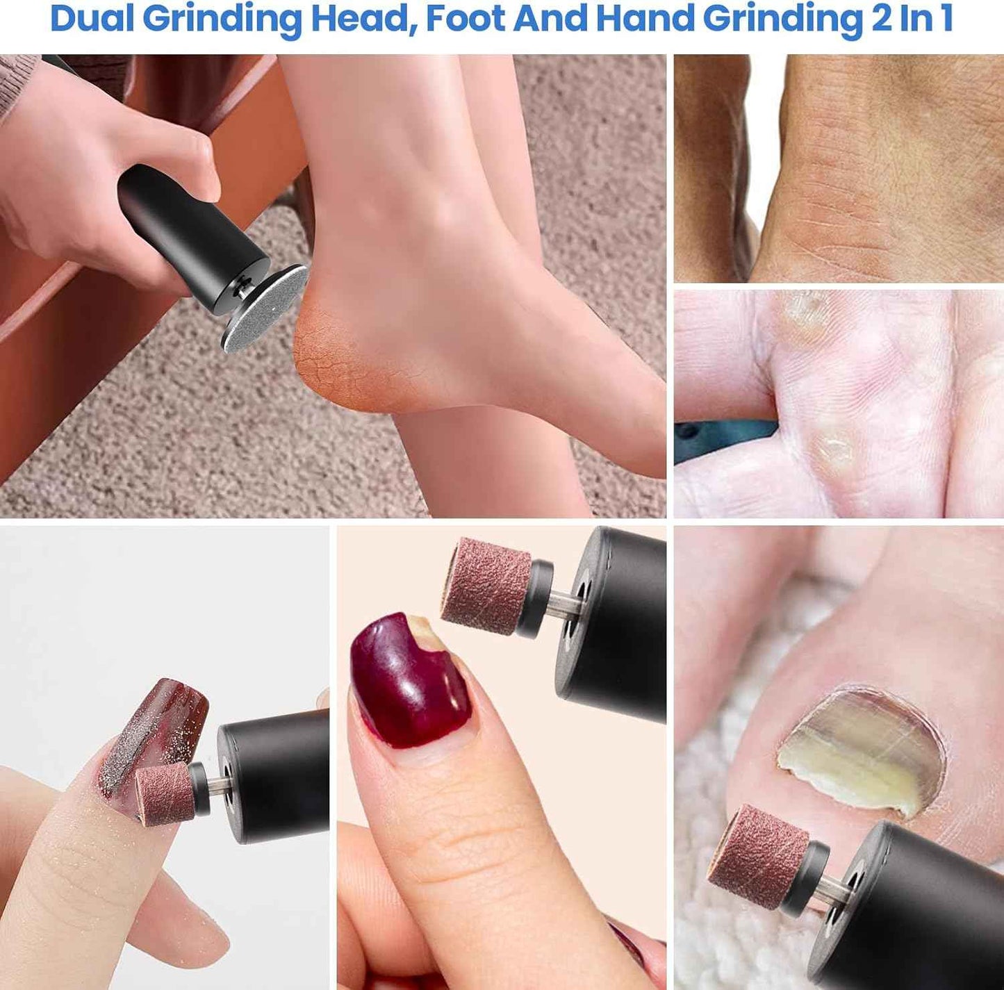 Electric Callus Remover for Feet with 120 Replacement Sandpaper Discs - Smooth Skin Solution