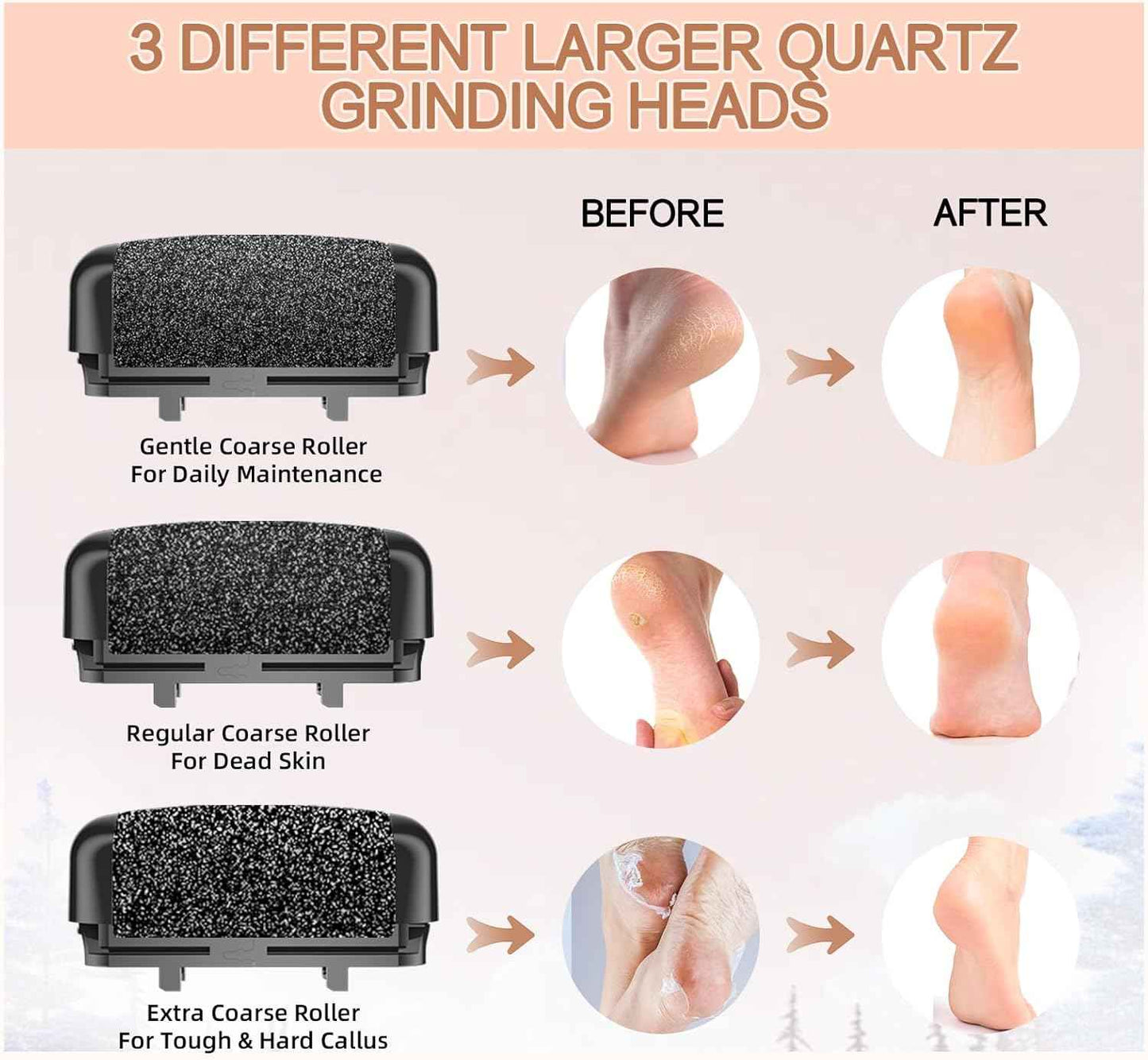 Rechargeable Electric Callus Remover for Feet - Waterproof Pedicure Tool for Hard Skin