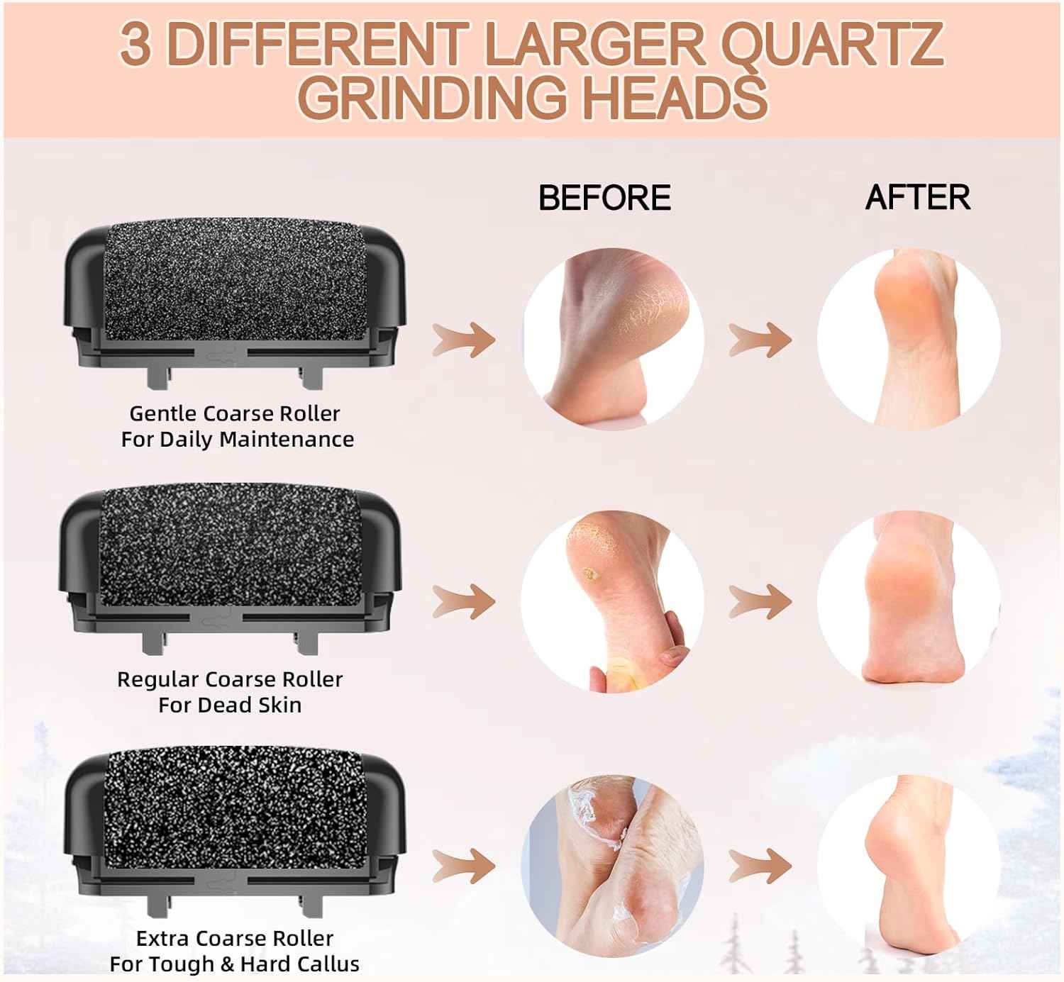 Rechargeable Electric Callus Remover for Feet - Waterproof Pedicure Tool for Hard Skin