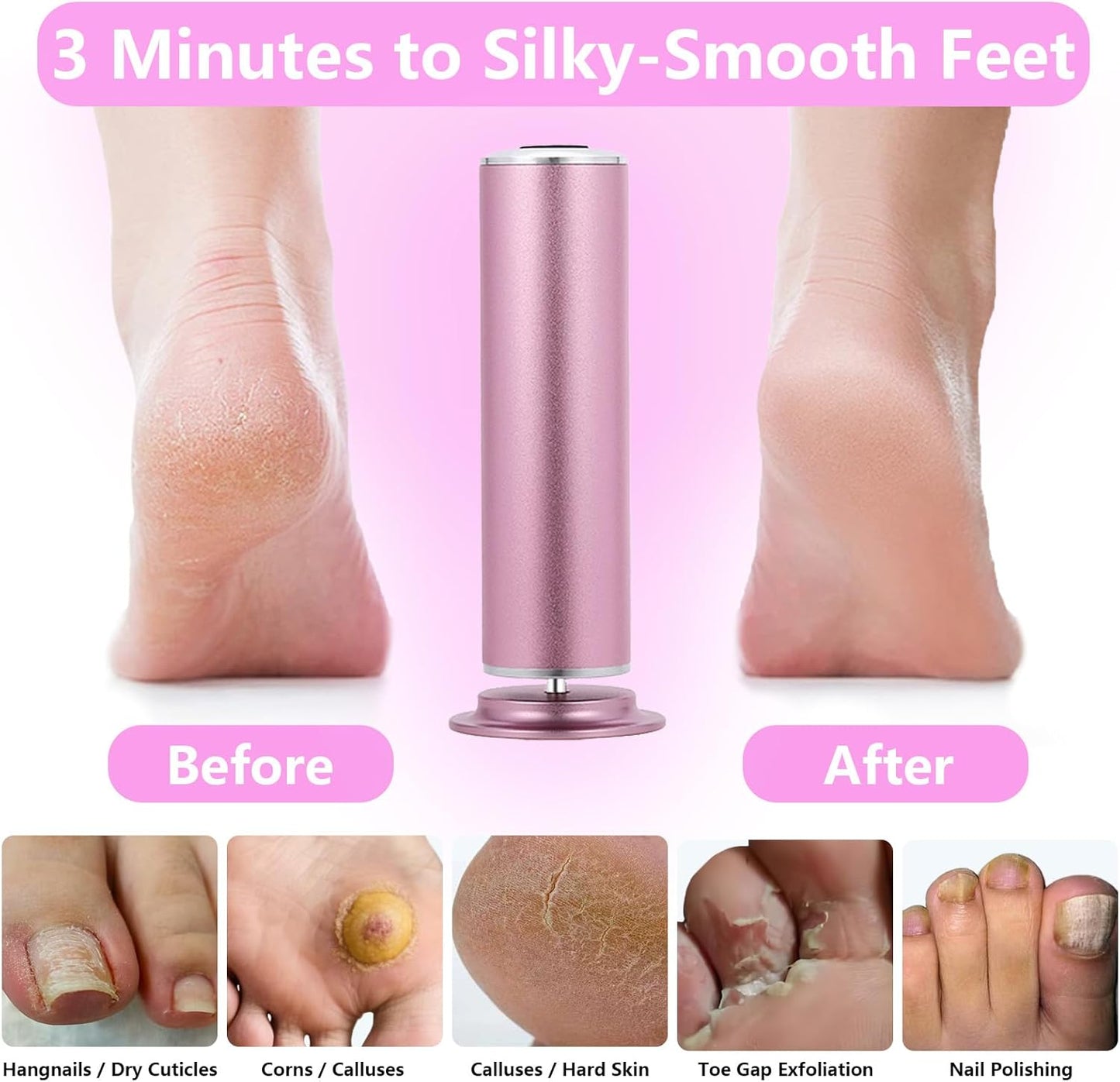 Electric Foot Callus Remover & Nail Drill - 60 Sandpapers, 20 Grinding Heads, Pink