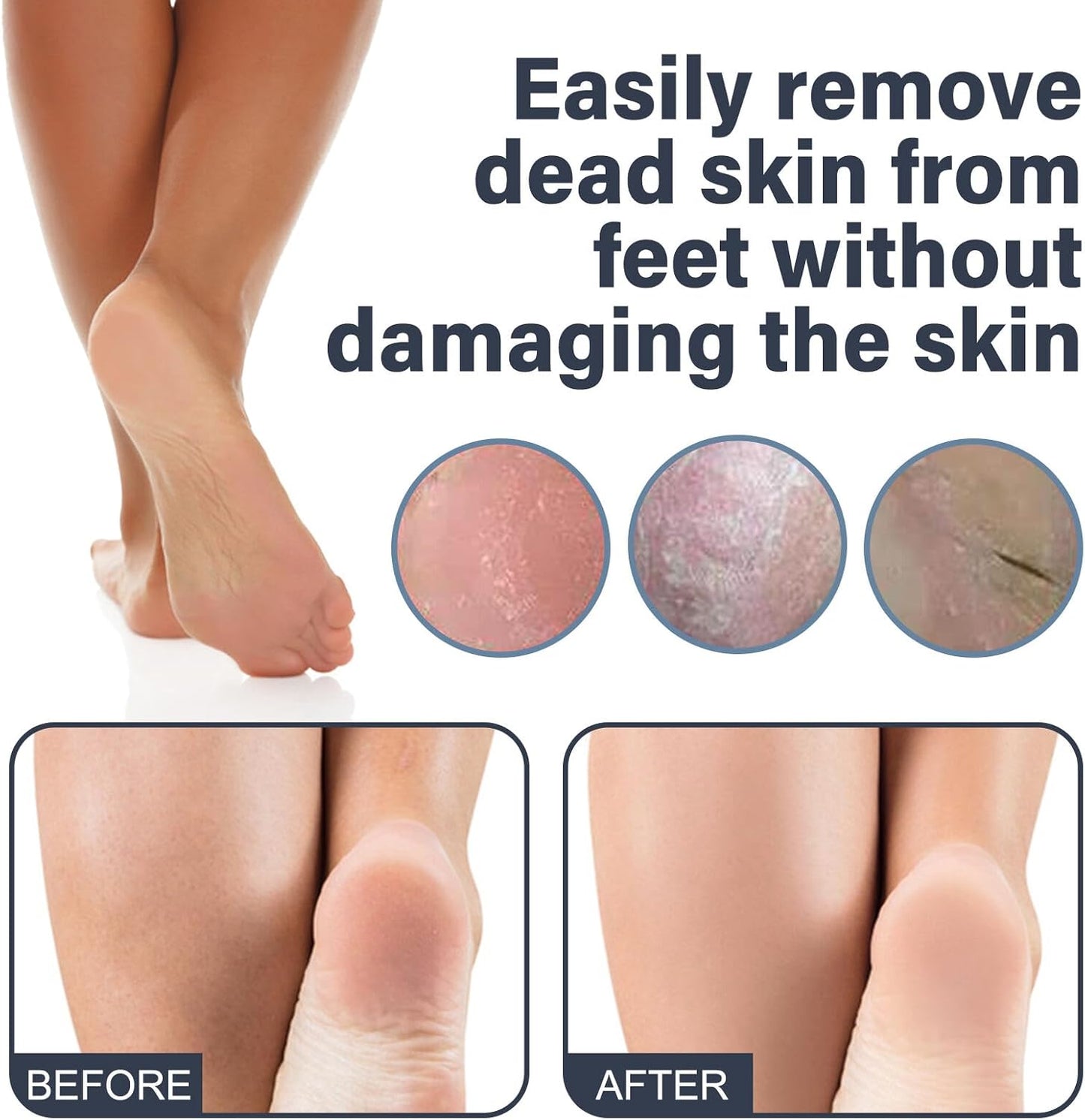 Electric Foot File Callus Remover for Smooth Feet - 60 Sandpaper Discs Included