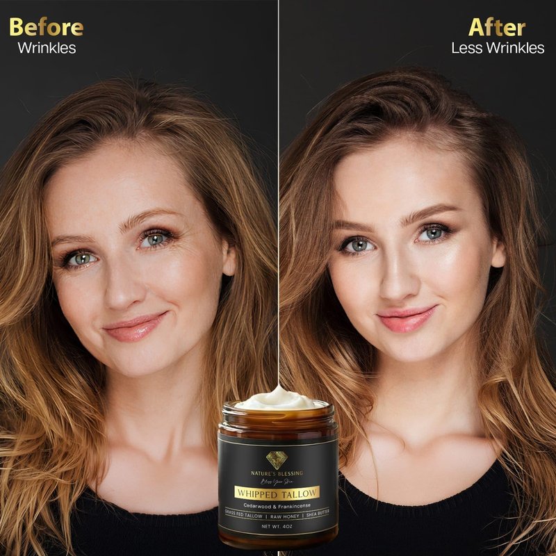 Nature's Blessing Anti-Aging Beef Tallow Cream for Fine Lines & Wrinkles | Collagen Booster Infused w/Organic Honey & Shea Butter | Deep Hydration for Youthful Glow (4oz, Cedarwood & Frankincense)