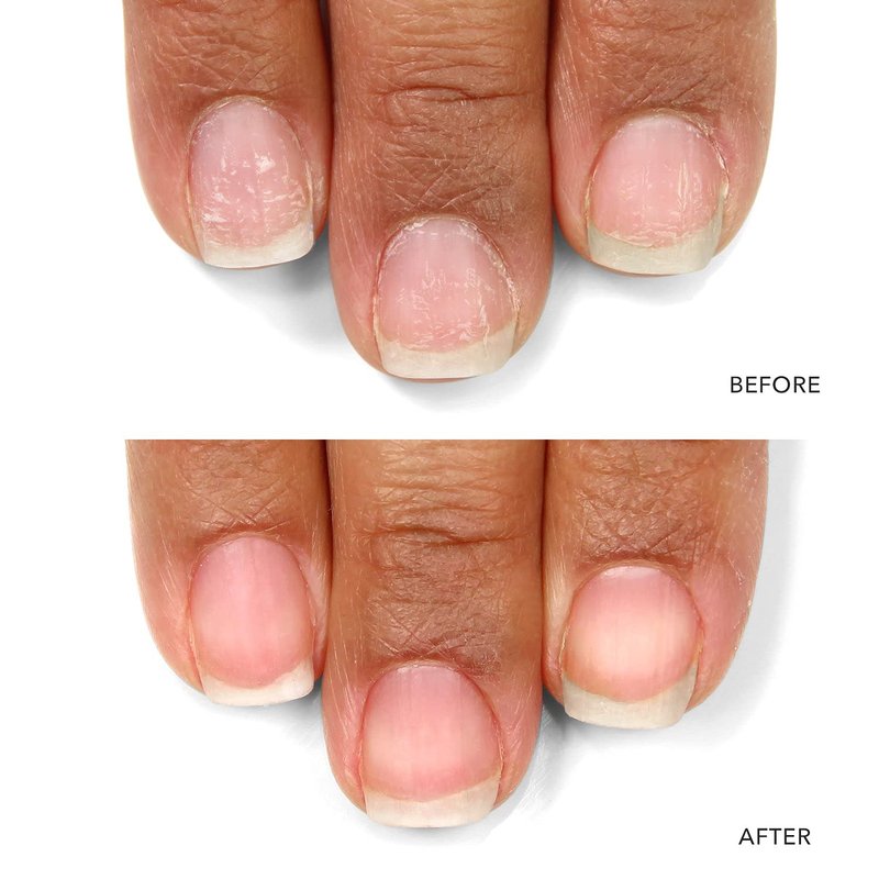 LONDONTOWN Nail Probiotic Instant Boost - Hydrating Nail Care Mask for Weak & Thin Nails | Repair Dry, Damaged Nails