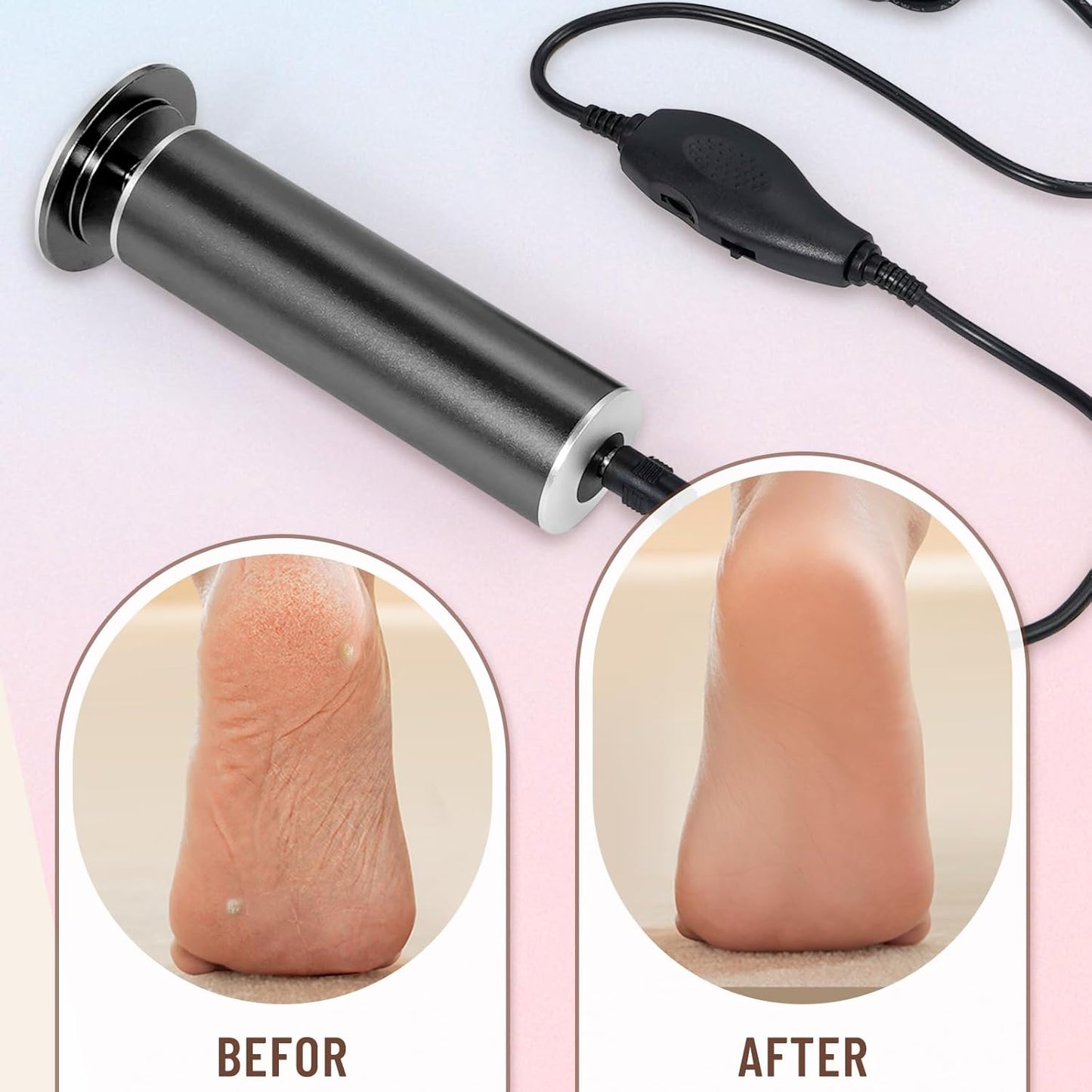 Professional Electric Foot File Callus Remover - Pedicure Tool with 60 Sandpaper Discs for Smooth Feet