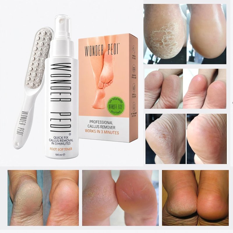 Callus Remover - Three Minutes Quick Fix- Foot File Rasp - Instant Foot Exfoliating Softener Peel Spray, Heels Callus Scrubber File - Home Spa Pedicure Treatment. Wonder Pedi
