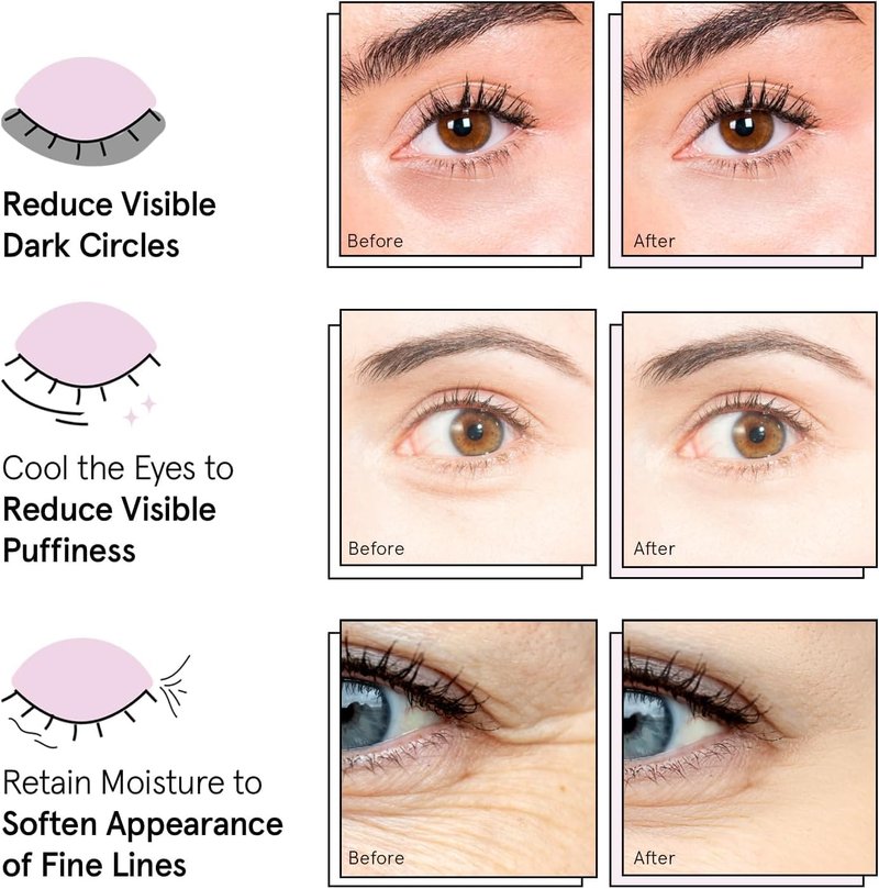 grace & stella Award Winning Under Eye Mask Reduce Dark Circles, Puffy Eyes, Undereye Bags, Wrinkles, Gel Under Eye Patches, New Mom Gifts - Vegan Self Care (48 Pairs, Blue)
