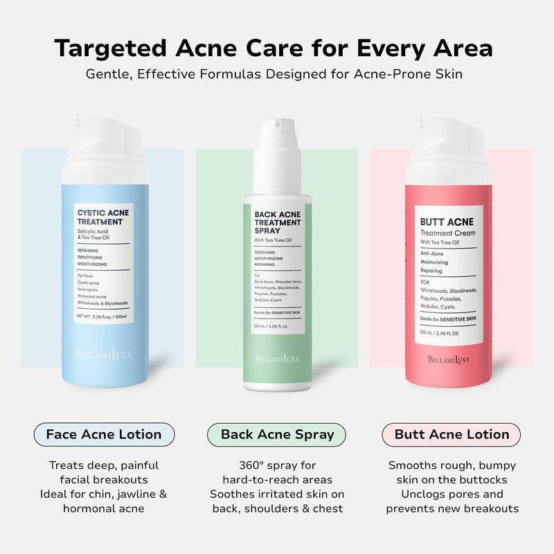 BellamiLuxx Fungal Acne Treatment Lotion: Effective Face & Body Pimple Cream for Bumps, Clusters, Itch & Redness – Fungal Prone Skin Acne Treatment Moisturizer for Teens & Adults with Natural Actives