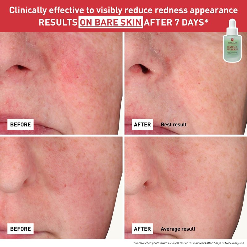 CENTELLA RED SERUM 10ML