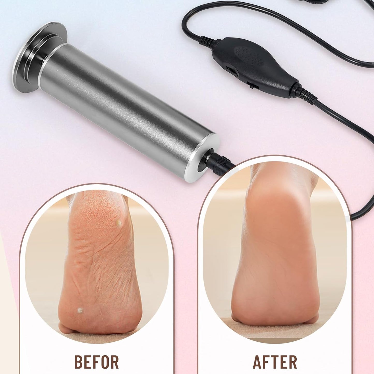 Professional Electric Foot File Callus Remover - Pedicure Tool with 60 Sandpaper Discs for Smooth Feet