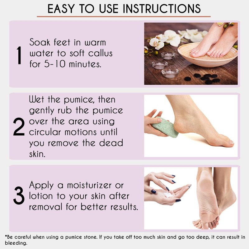 Karlash Professional Pedicure Foot Pumice Stone for Feet Skin Callus Remover and Scrubber for Dead Skins 2 Sided (Pack of 4)