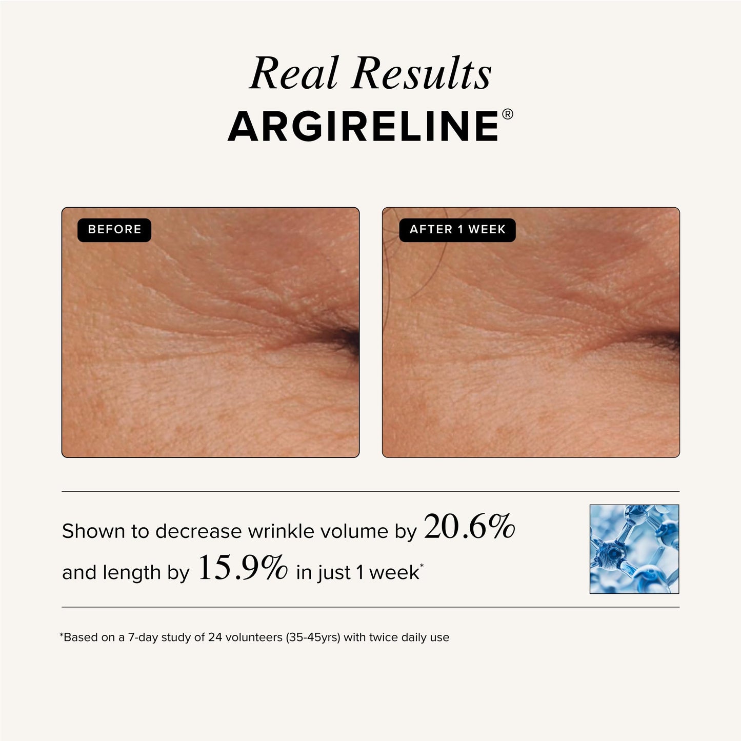 Asterwood Naturals Triple Repair Matrixyl 3000 1 oz + Argireline Peptide Serum 1 oz