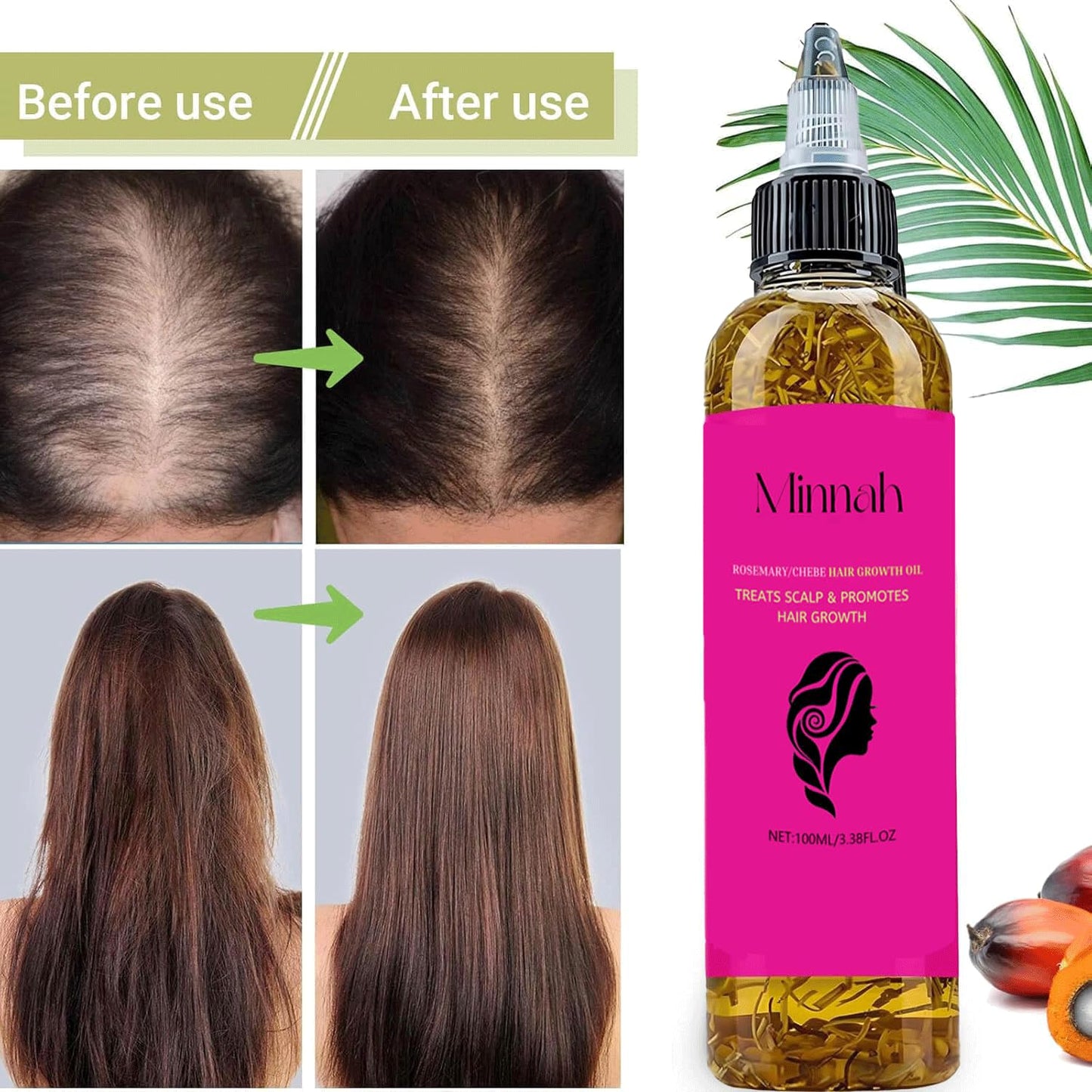 Minnah Batana Oil for Hair Growth - 4-in-1 Nourishing Formula with Rosemary & Pumpkin Seed | 1 oz