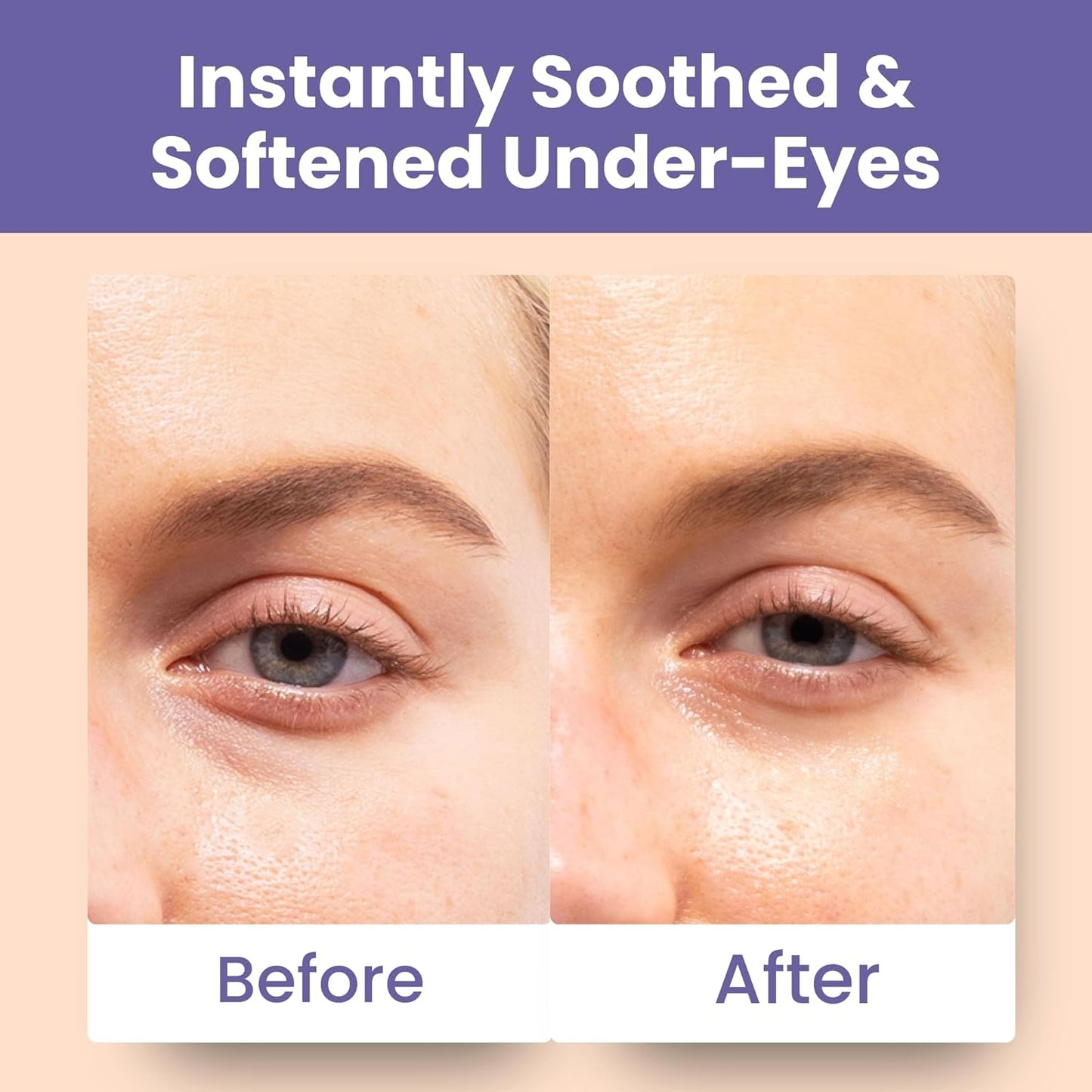 Patchology Soothing Eye Gels - Ultra-Soft Hydrogel Undereye Masks with Ectoin & Ceramides | Hydrate & Refresh Tired Eyes (5 Pack)