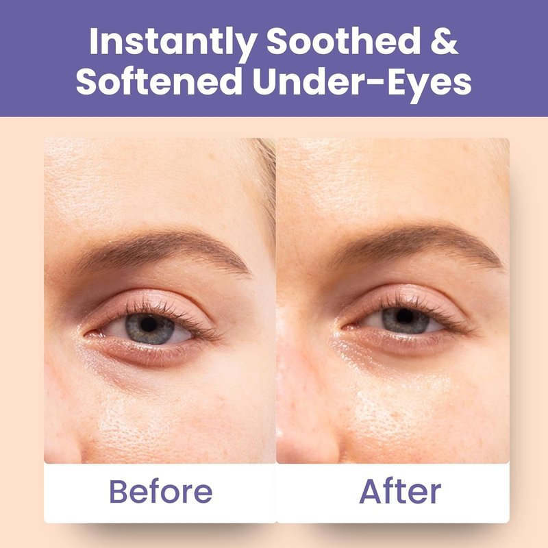 Patchology Soothing Eye Gels - Ultra-Soft Hydrogel Undereye Masks with Ectoin & Ceramides | Hydrate & Refresh Tired Eyes (5 Pack)