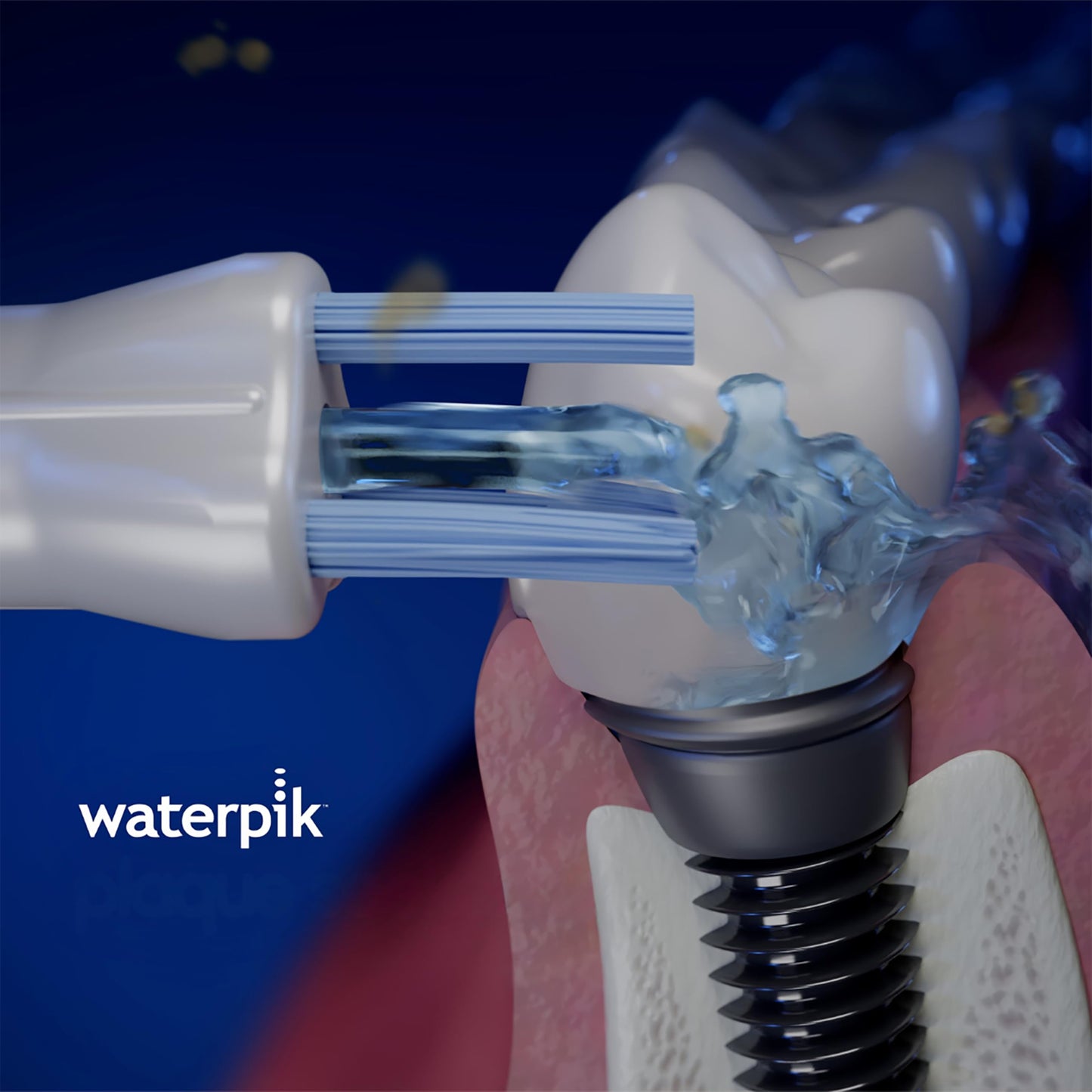 Waterpik Water Flosser Plaque Seeker Replacement Tips, 2 Count PS-100E